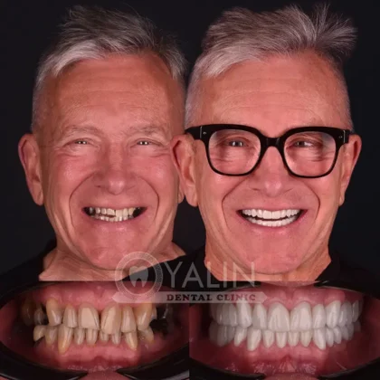 Yalın Dental Clinic