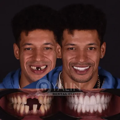 Yalın Dental Clinic