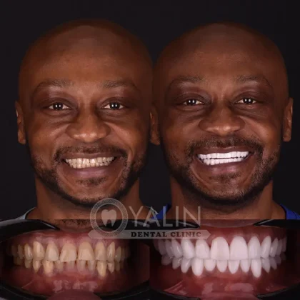 Yalın Dental Clinic