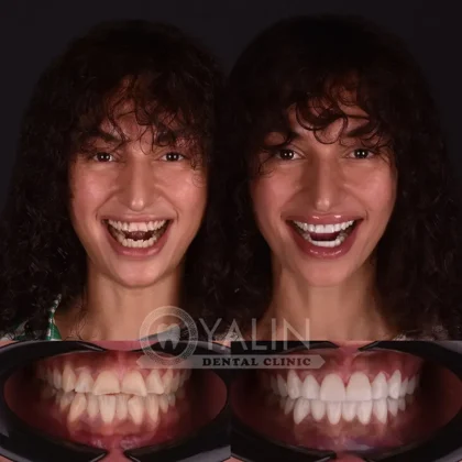 Yalın Dental Clinic