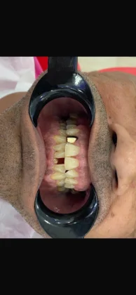 Zirve Dental Marmaris