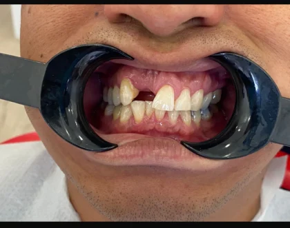 Zirve Dental Marmaris