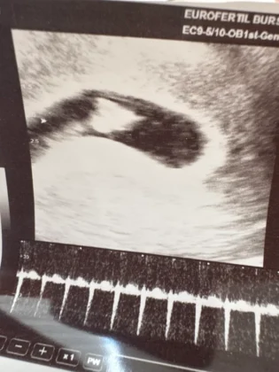 Bursa EUROFERTIL IVF Center