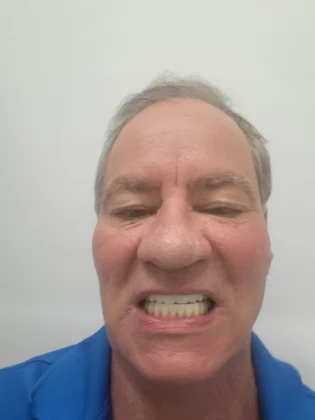 Sonría Dental Clinic – Costa Rica Dental Implants Sonría Dental Clinic – Costa Rica Dental Implants