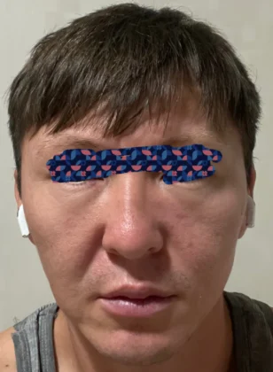 SAERO Plastic Surgery