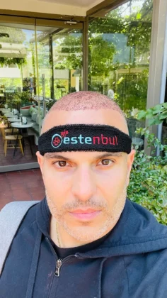 Estenbul Health Hair Transplant Clinic