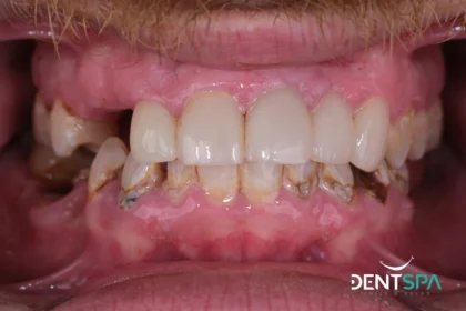 DentSpa