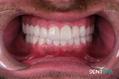 DentSpa