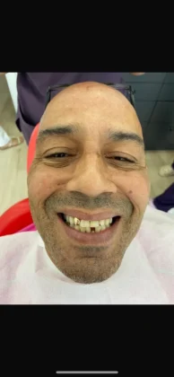Zirve Dental Marmaris