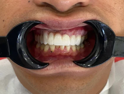 Zirve Dental Marmaris