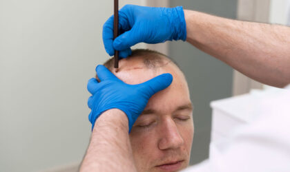 Estemarley | Hair Clinic Estemarley | Hair Clinic