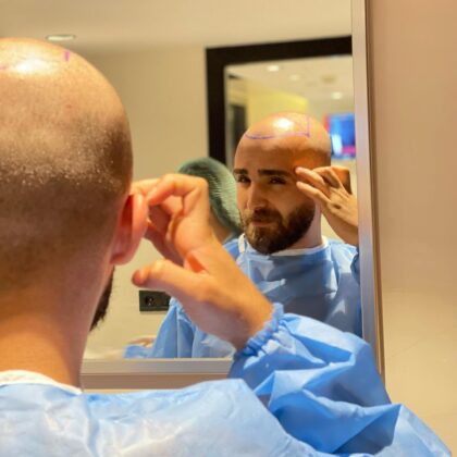 Estemarley | Hair Clinic Estemarley | Hair Clinic