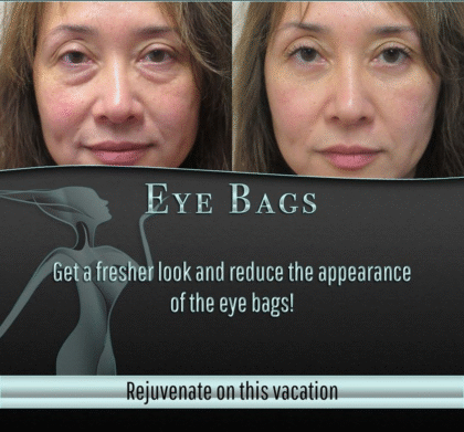 Cozumel Rejuvenation Clinic Cozumel Rejuvenation Clinic