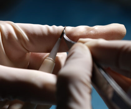 Estemarley | Hair Clinic Estemarley | Hair Clinic