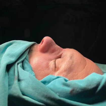 Prof. Furkan Karabekmez’s Aesthetic Surgery Clinic