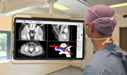 Netherlands Cancer Institute – NKI-AVL