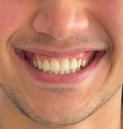 DM Klinik