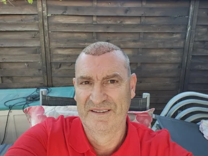 Estemarley | Hair Clinic Estemarley | Hair Clinic