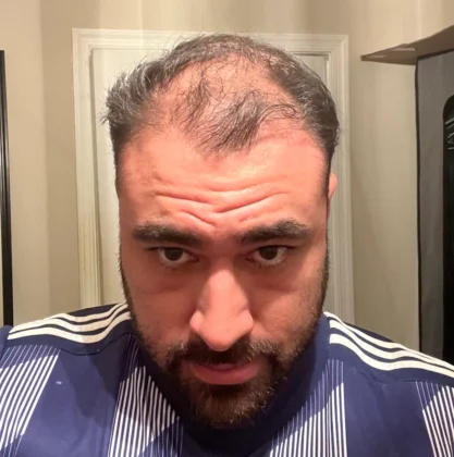 İstanbul Hair Center