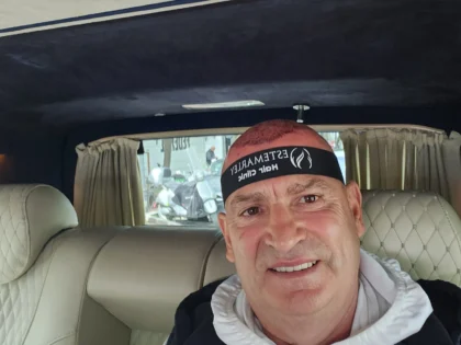 Estemarley | Hair Clinic Estemarley | Hair Clinic