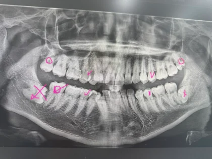 Gangnam Gentle Dental