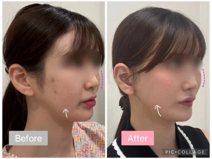 RNWOOD Plastic Surgery