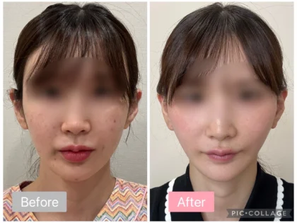 RNWOOD Plastic Surgery