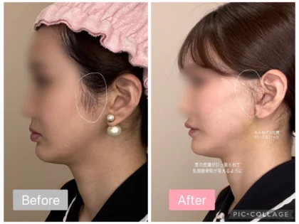 RNWOOD Plastic Surgery