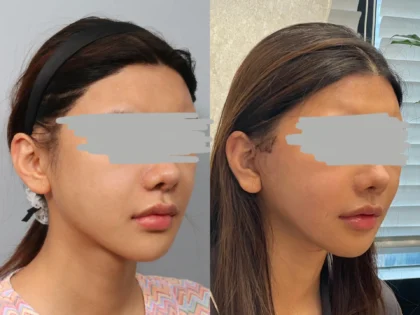 RNWOOD Plastic Surgery