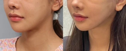 RNWOOD Plastic Surgery