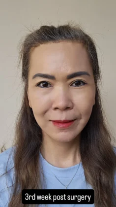 RNWOOD Plastic Surgery
