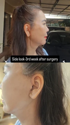 RNWOOD Plastic Surgery