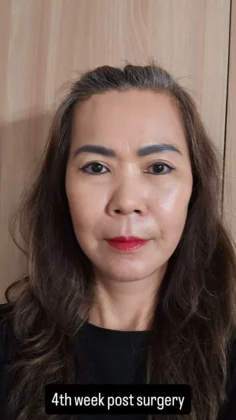 RNWOOD Plastic Surgery