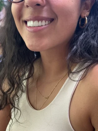 Sonrisa Italiana Sonrisa Italiana