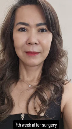 RNWOOD Plastic Surgery
