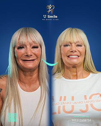 U Smile Dental Clinic