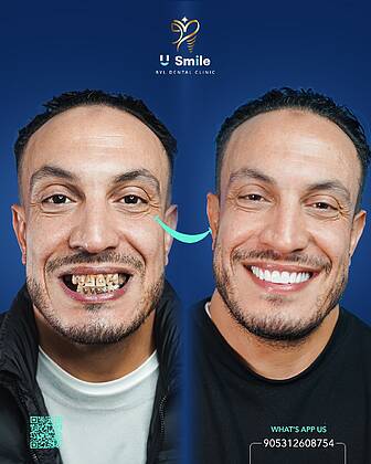 U Smile Dental Clinic