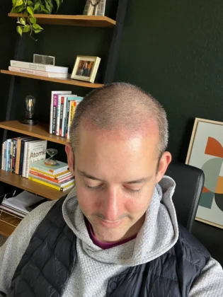 Dr. Ziya Yavuz Hair Transplant Clinic