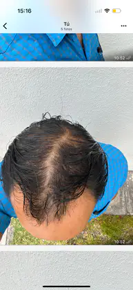 UnitedCare Hair Transplant Clinic