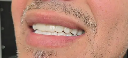 U Smile Dental Clinic