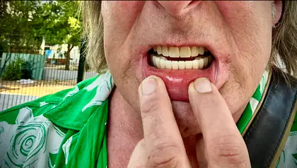 Global Dental Center Global Dental Center