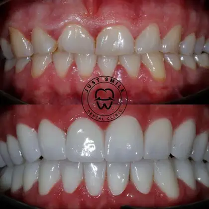 Just Smile Dental Clinic