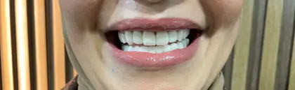 U Smile Dental Clinic