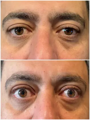 Dünyagöz Eye Hospital Istanbul Etiler Dünyagöz Eye Hospital Istanbul Etiler