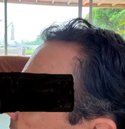 UnitedCare Hair Transplant Clinic