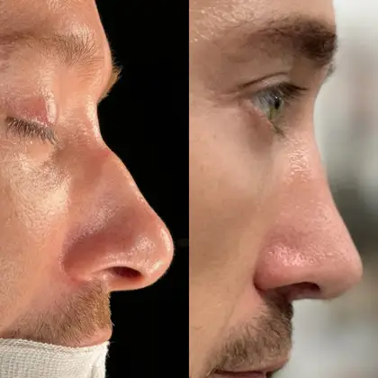 Op. Dr. Sinan Eroğlu Clinic Op. Dr. Sinan Eroğlu Clinic