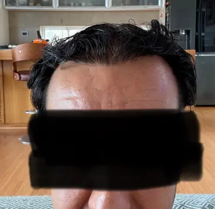 UnitedCare Hair Transplant Clinic