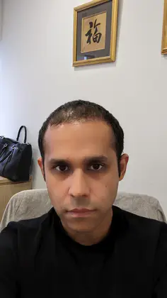 UnitedCare Hair Transplant Clinic