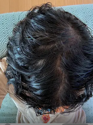 UnitedCare Hair Transplant Clinic