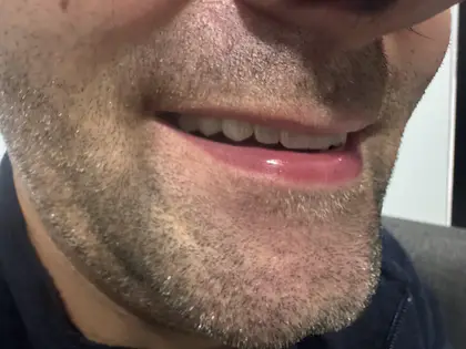 U Smile Dental Clinic